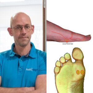 Lees meer over het artikel Podotherapie bij Fysiq Vision
